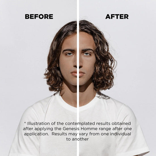 Before and after results of using Kerastase Genesis Homme serum for reducing hair thinning in men